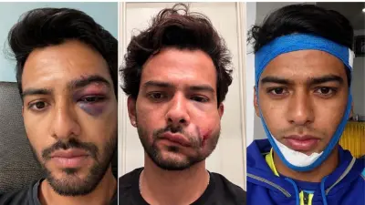 From Century To Horror Injury In 24 Hours: Fomer India Star Shares Update | WATCH